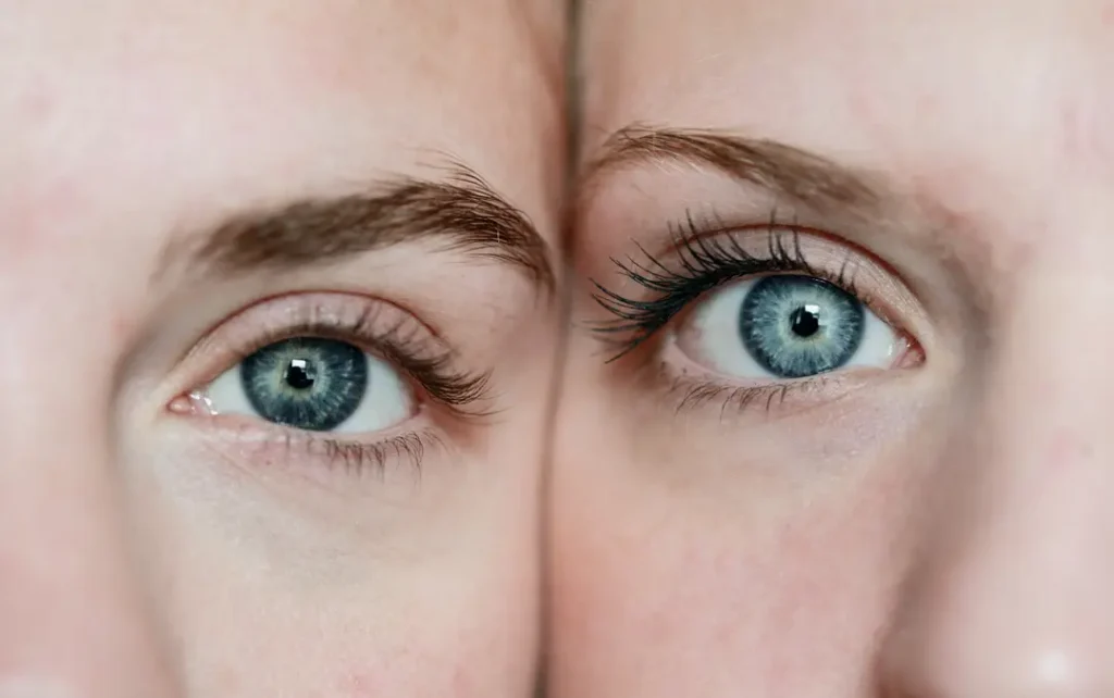 Lähisukulaisenkin kokemus laserleikkauksesta samalla klinikalla ja silmäkirurgilla voi olla aivan erilainen, koska silmien rakennetyypit ovat yleensä sisaruksillakin erilaiset, ja kirurgit osaavat hoitaa eri tavoin erilaisia rakennetyyppejä.